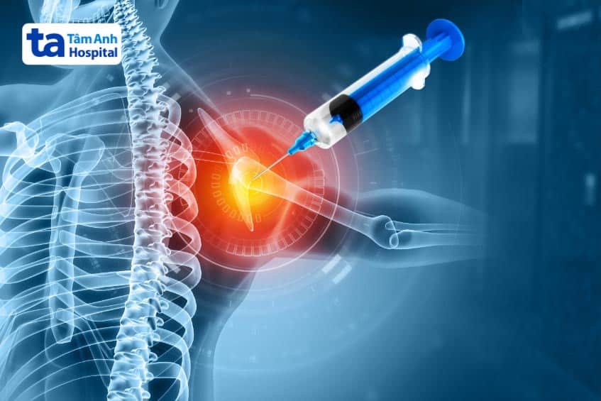 Khô khớp vai: Nguyên nhân, cách chữa và giải pháp phòng ngừa