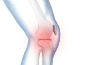 Thay khớp gối toàn phần ở bệnh nhân 80 tuổi 6 Đau khớp gối, chuyên gia y học Trương Hữu Bảo.