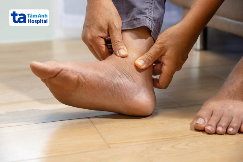 Bệnh sưng khớp là gì? Nguyên nhân, triệu chứng và cách điều trị 2 Bệnh sưng khớp là gì? Nguyên nhân, triệu chứng và cách điều trị