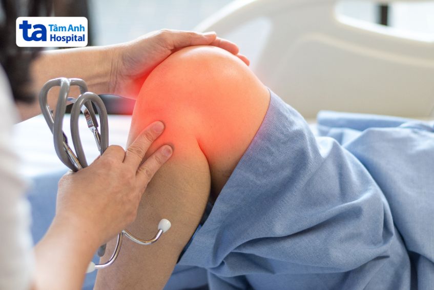 Viêm màng hoạt dịch thể lông nốt sắc tố: Dấu hiệu và cách điều trị 3 Viêm màng hoạt dịch thể lông nốt sắc tố: Dấu hiệu và cách điều trị
