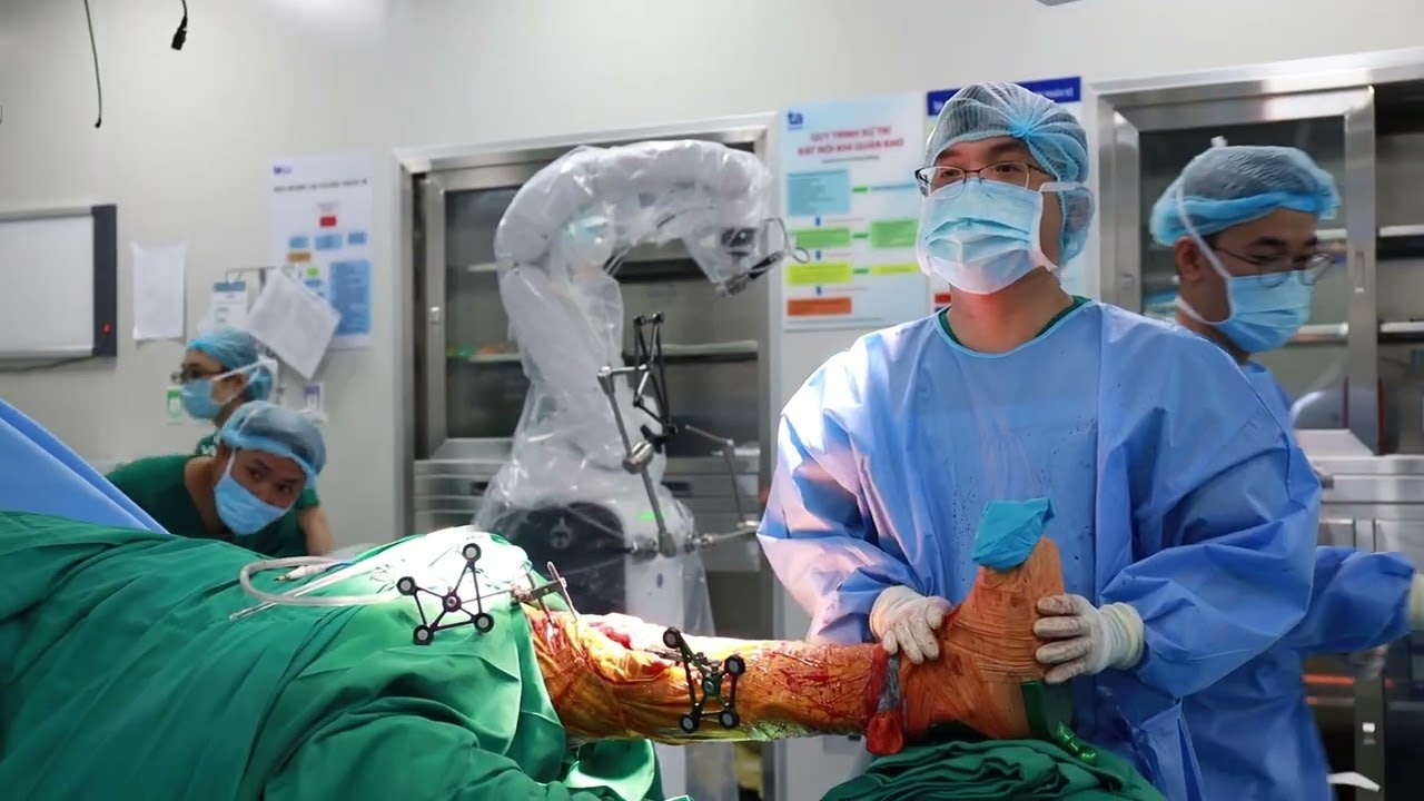 Thay 2 khớp gối bằng Robot CUVIS AI cho bệnh nhân 63 tuồi 2 Ưu điểm của phẫu thuật thay khớp gối bằng robot Cuvis AI