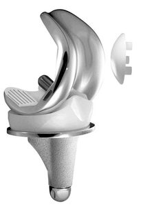 Biến chứng sau khi thay khớp gối có thể gặp phải 3 Lưu nháp tự động