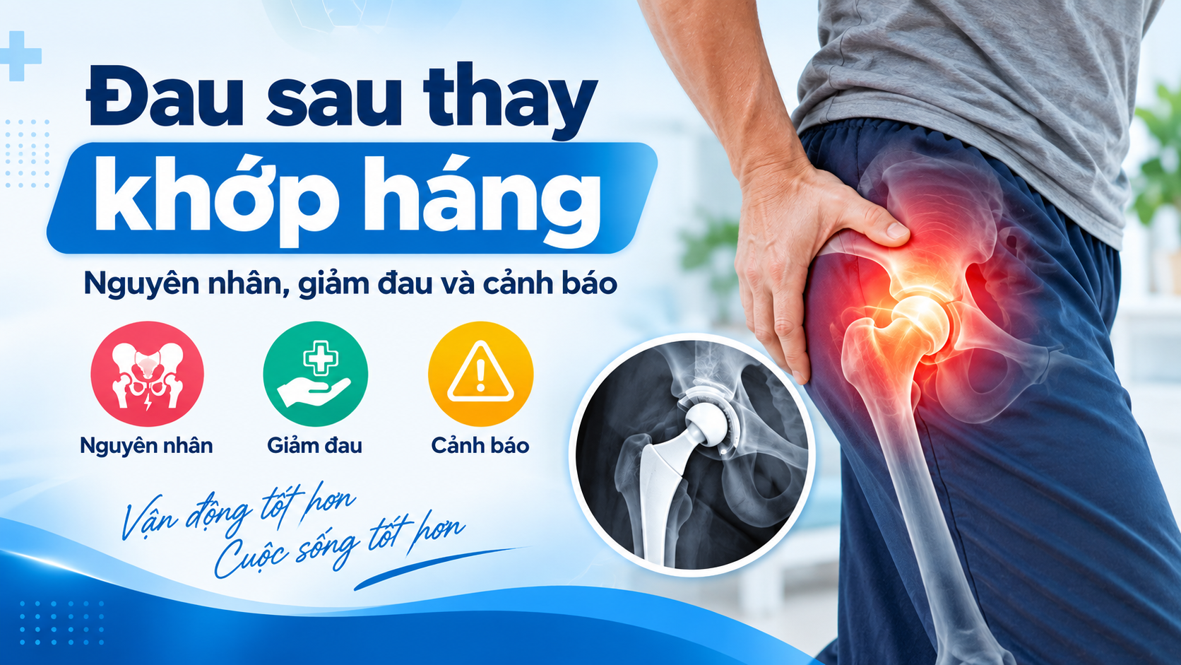 Đau sau thay khớp háng: Nguyên nhân, giảm đau và cảnh báo 10 Đau sau thay khớp háng: Nguyên nhân, giảm đau và cảnh báo